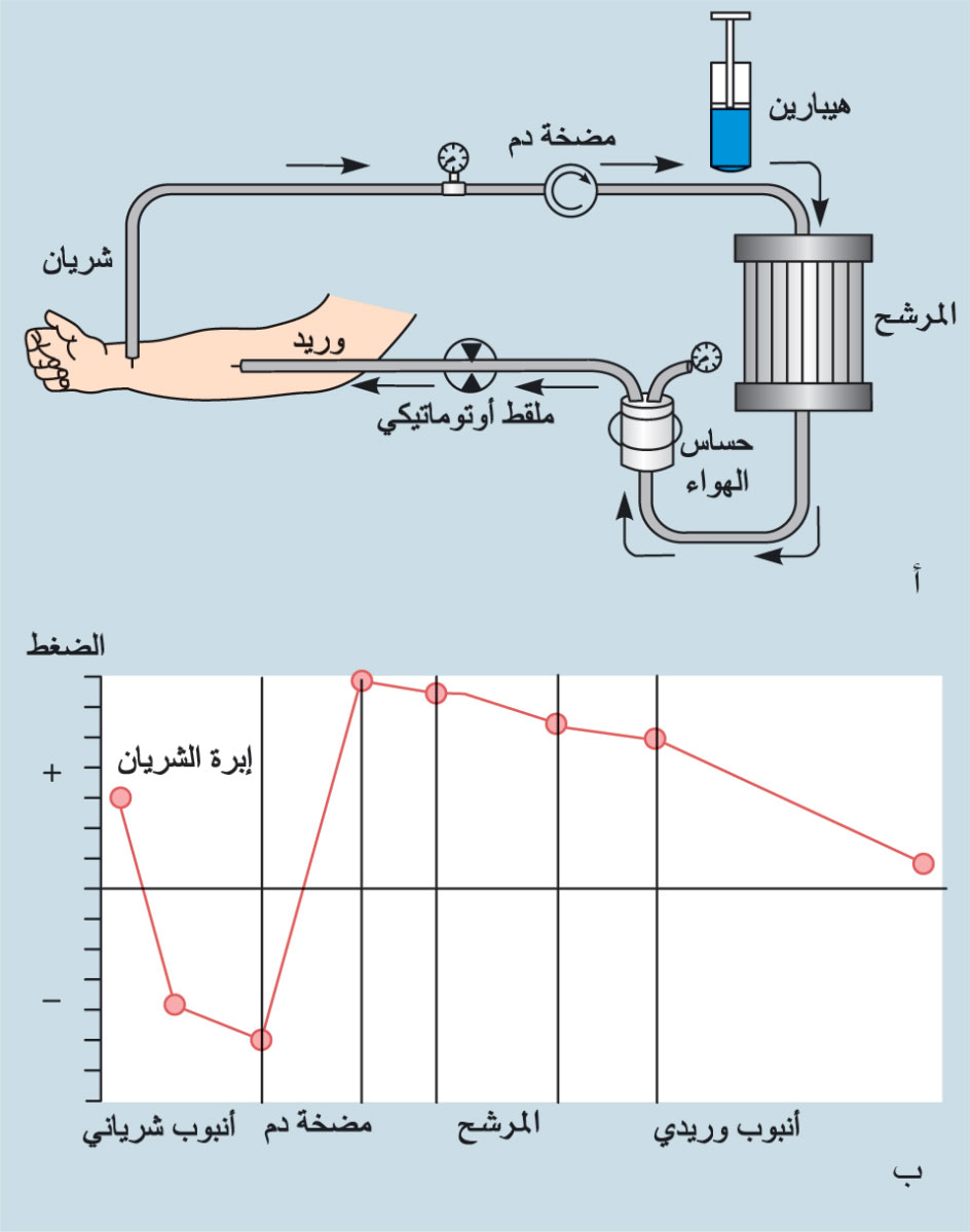 دارة الدم في أثناء التحال الدموي