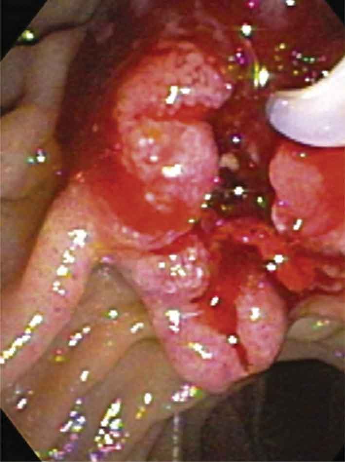 مظهر تنظيري لسرطانة مجل فاتر